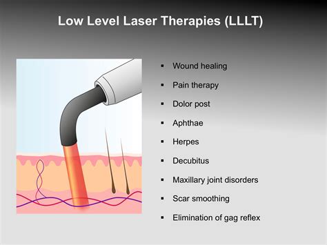 low level laser therapy stirling|Low.